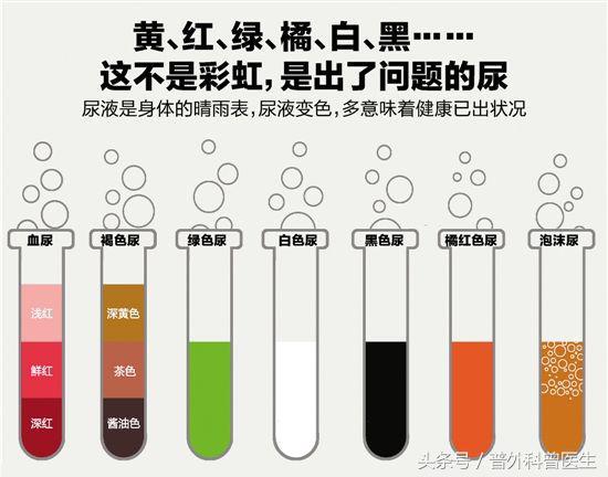 看不懂血,尿,便常規的報告單?醫生手把手教你,保證你一學就會