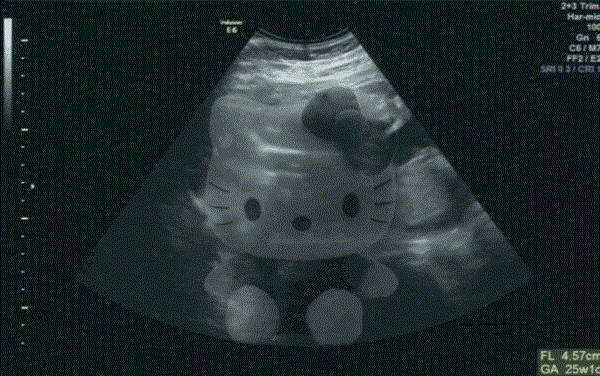 我怀孕了套路表情包：搞笑B超图