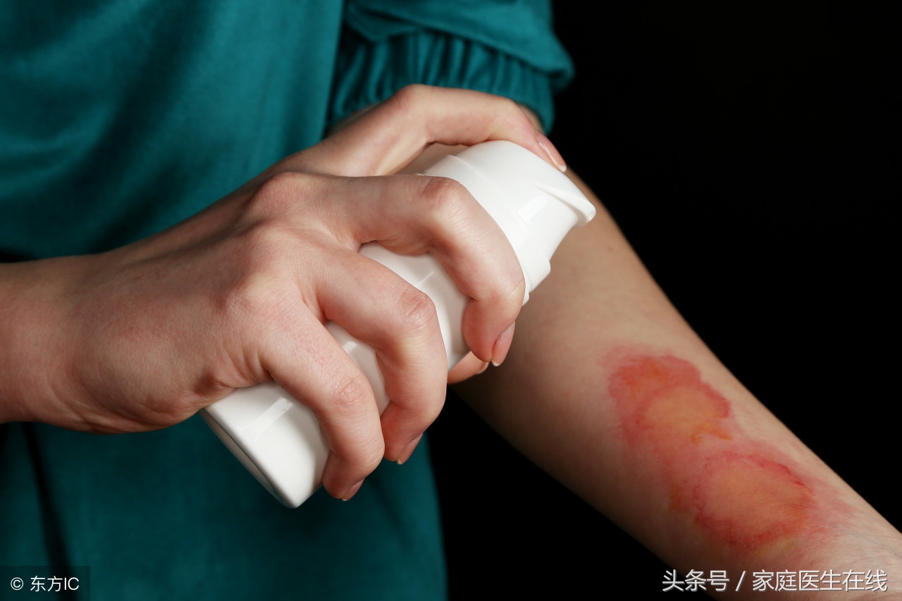 皮肤烫伤应急处理方法：快速降温、保护创面、及时就医，避免感染加重伤情