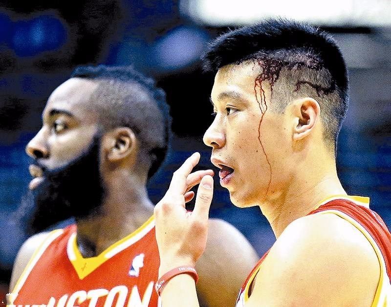 为什么nba流血(有一种血性叫”浴血奋战“！艾弗森为了能继续战斗，把血咽进肚子)