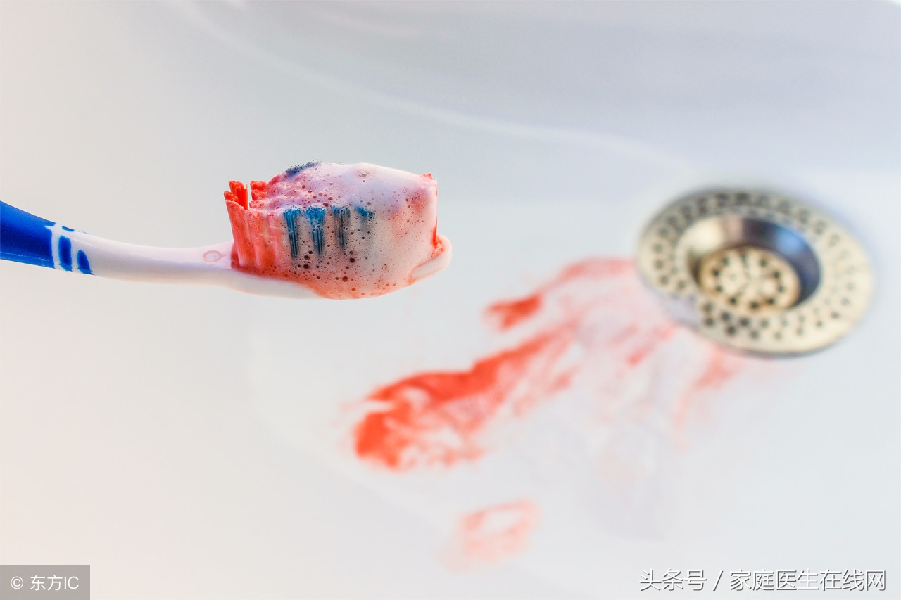 刷牙时牙龈经常出血是什么原因及解决方法