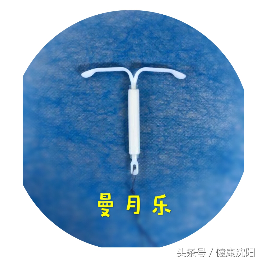 五,常见的节育器种类