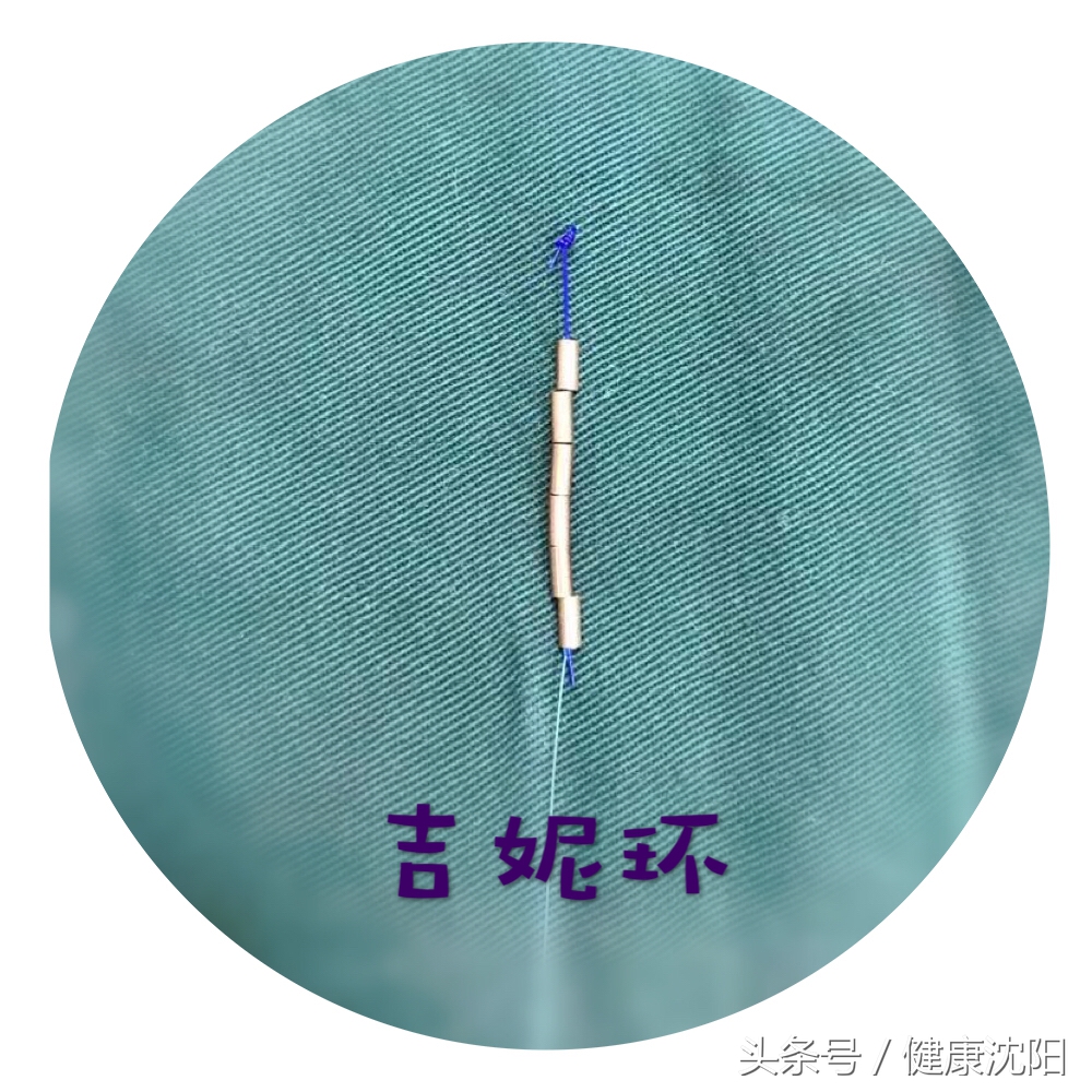 五,常见的节育器种类