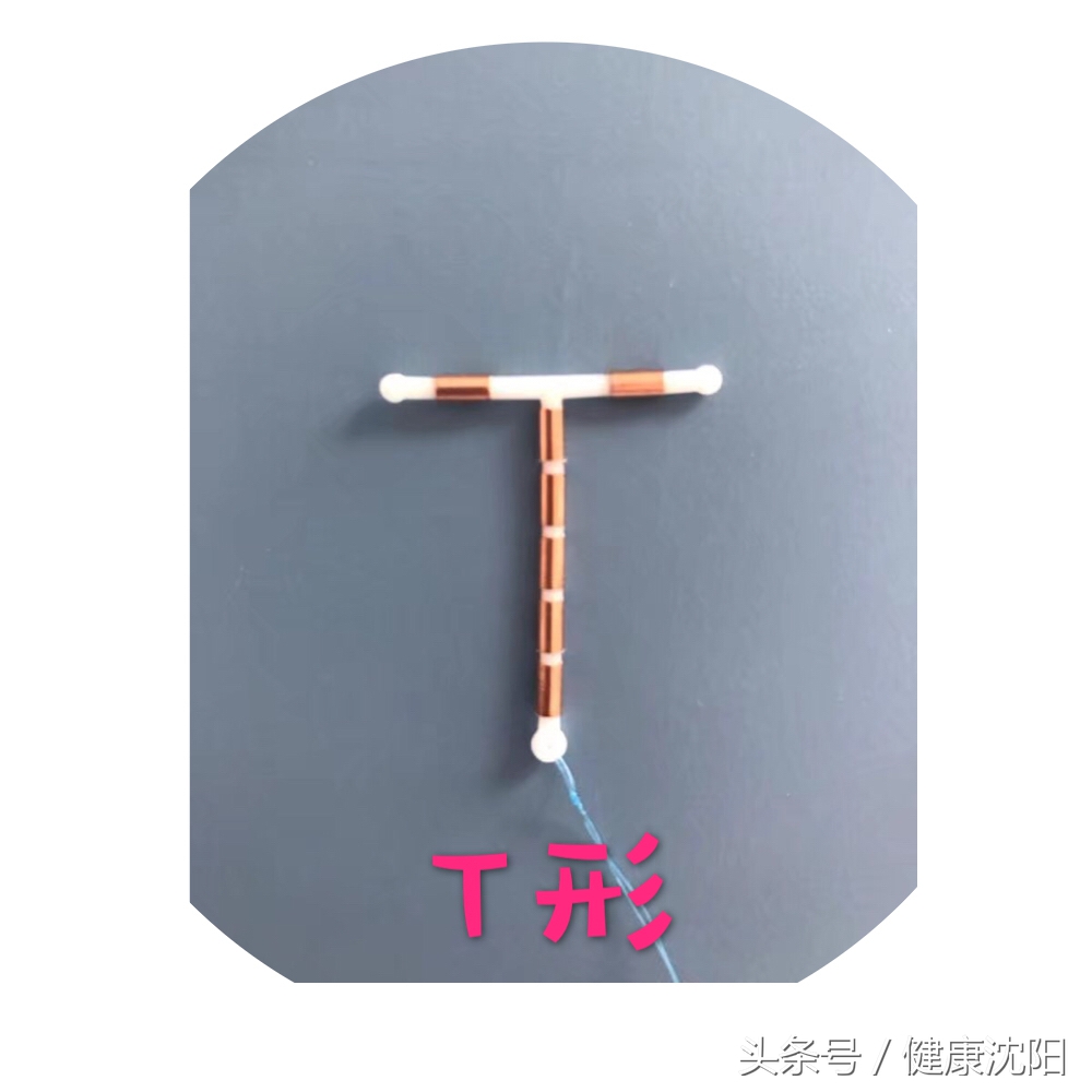 健康科普堂|世界避孕日,专家跟您聊聊上环那些事儿