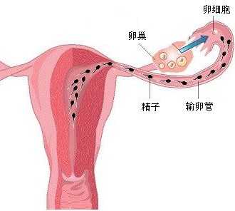 人工受精和试管婴儿的区别