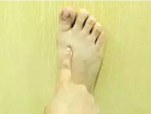 病是“气”出来的，爱生气的人，要防5病，做4事，消消气，少生病