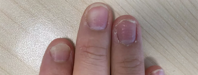 做美甲多久后必须要卸甲？一定要去美甲店卸甲吗？