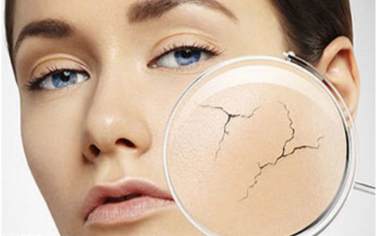 皮肤瘙痒、泛红、干燥怎么办？发现问题、“对症下药”才有效