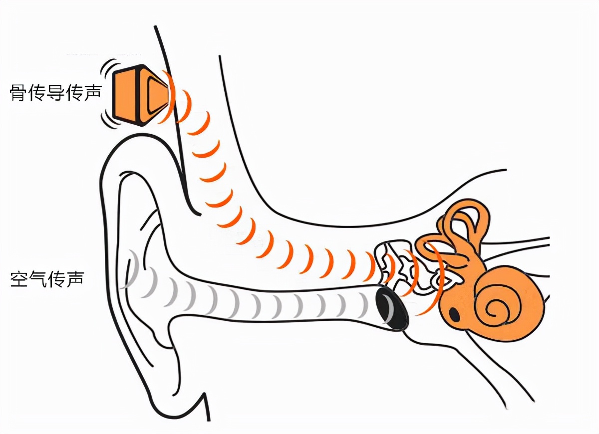 骨传导耳机哪个牌■子好？骨传导▲耳机评测，骨传导选购推荐