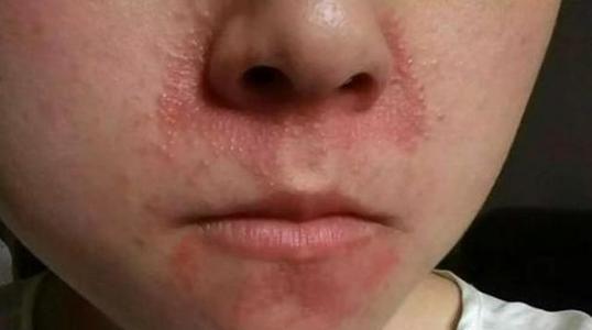 以前农村父母喜欢收集公羊胡子,收集这个干什么?并不是为了卖钱