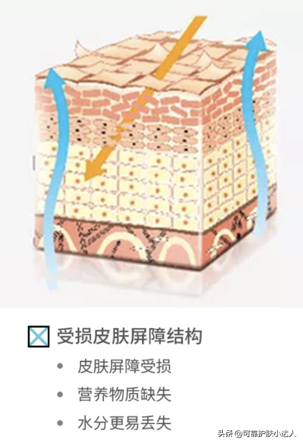 今日分享修复肌肤屏障，改善各种肌肤问题的第一步