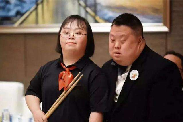 唐氏儿是什么样子图片(唐氏儿) - 赤虎壹号