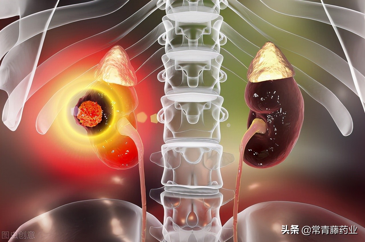 慢性肾脏病影响老人生活质量，中医教您养护肾脏方法