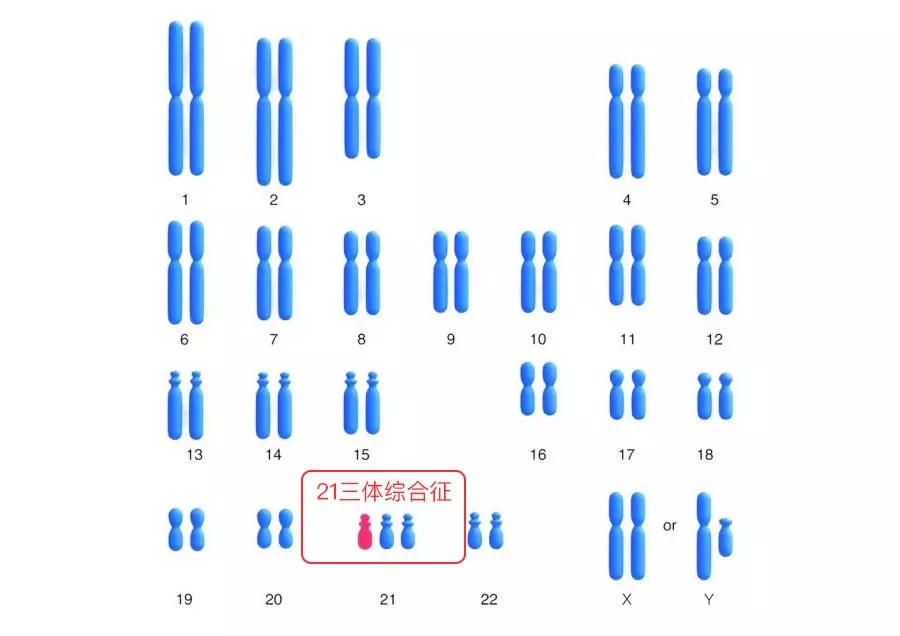 什么是唐筛 唐筛必须要做吗