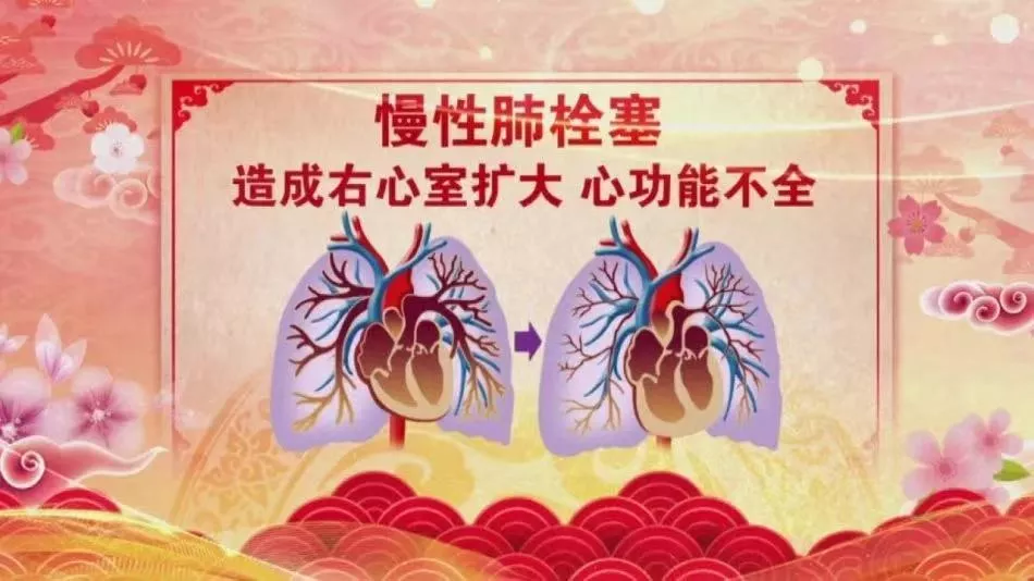 比腰肌劳损更可怕的“腰痛”，误诊率高达60%！这些医生也可能弄混的疾病，要提高警惕