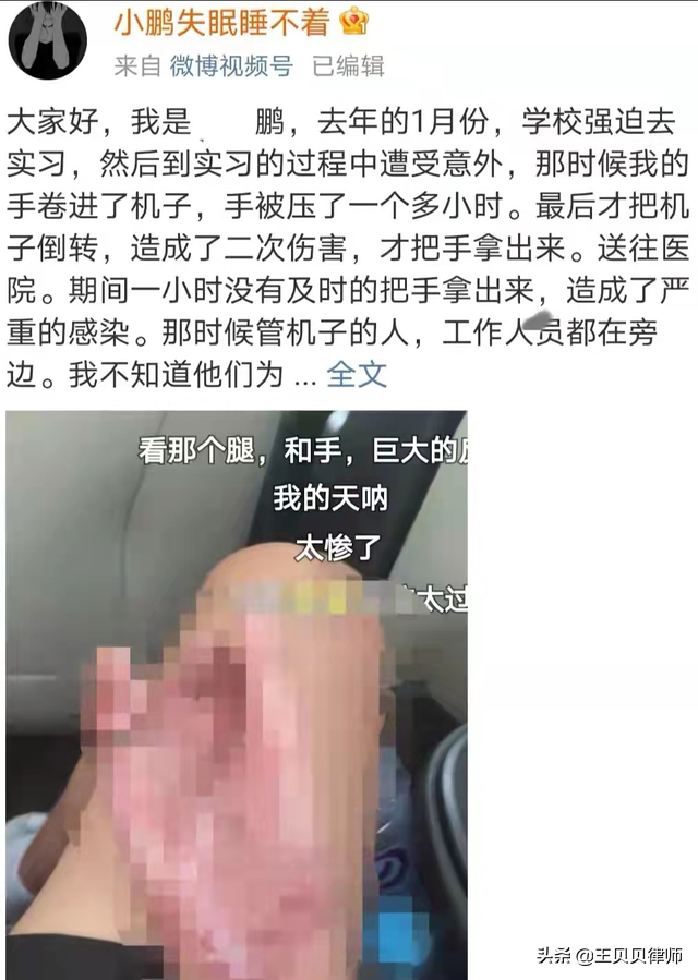 19岁被强制实习，手卷入机器一小时才取出：致残！学校称自己协商