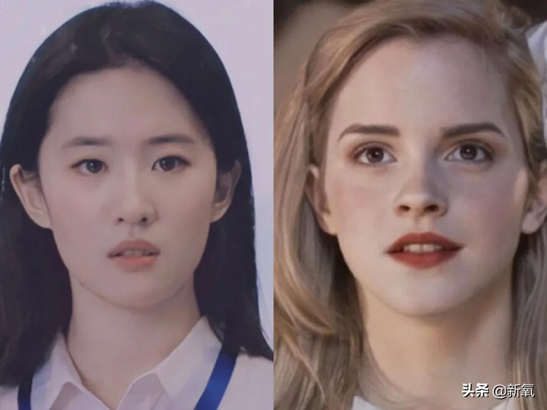 姐妹,双眼皮再好,咱也别硬割啊