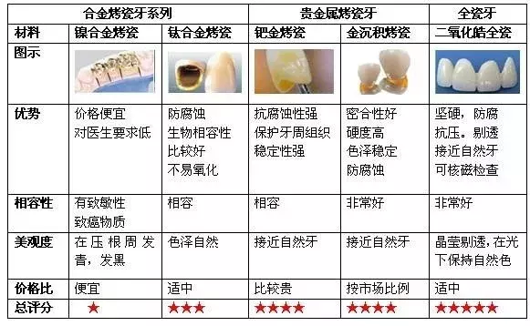烤瓷牙、全瓷牙哪个更好?优缺点对比分析