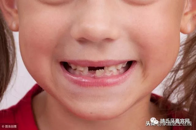 为什么你家宝宝易患龋齿？婧氏儿童牙膏能预防虫牙蛀牙吗？