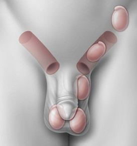 宝宝的“蛋蛋”不见了？别不当回事