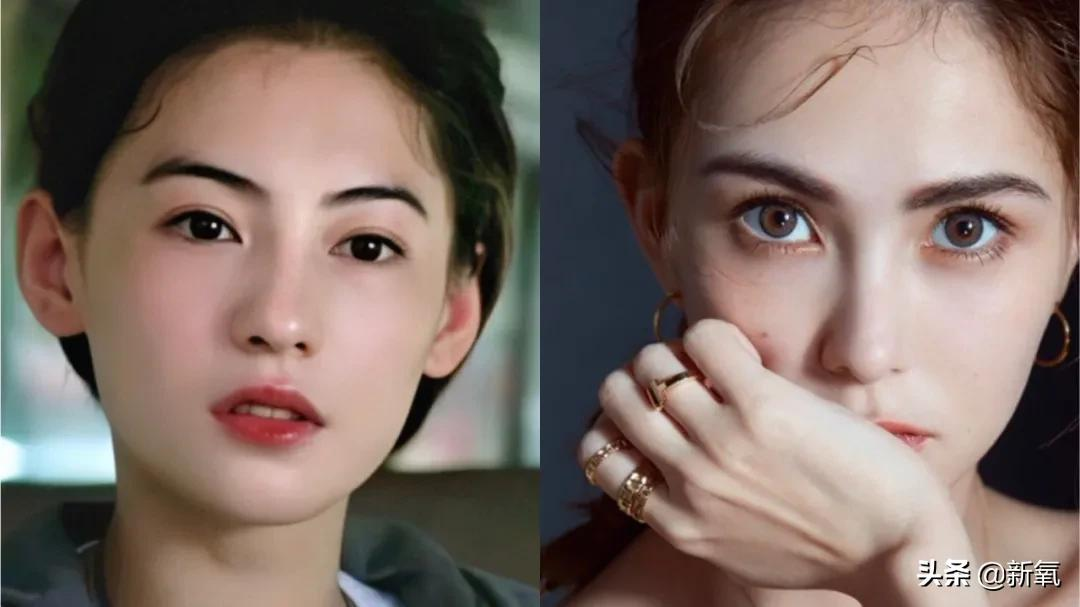姐妹,双眼皮再好,咱也别硬割啊