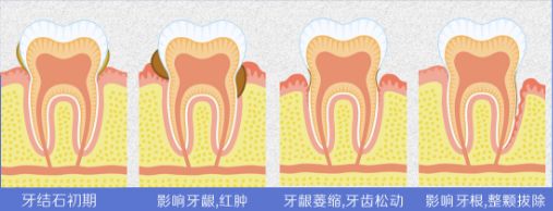牙疼几百块能搞定，去医院却花了几千？其实90%的钱你白花了