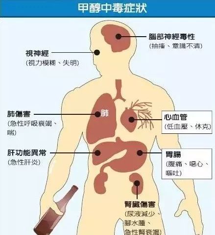 头一天喝醉，第二天起床头疼难受，再喝点酒反而舒服，为什么呢？