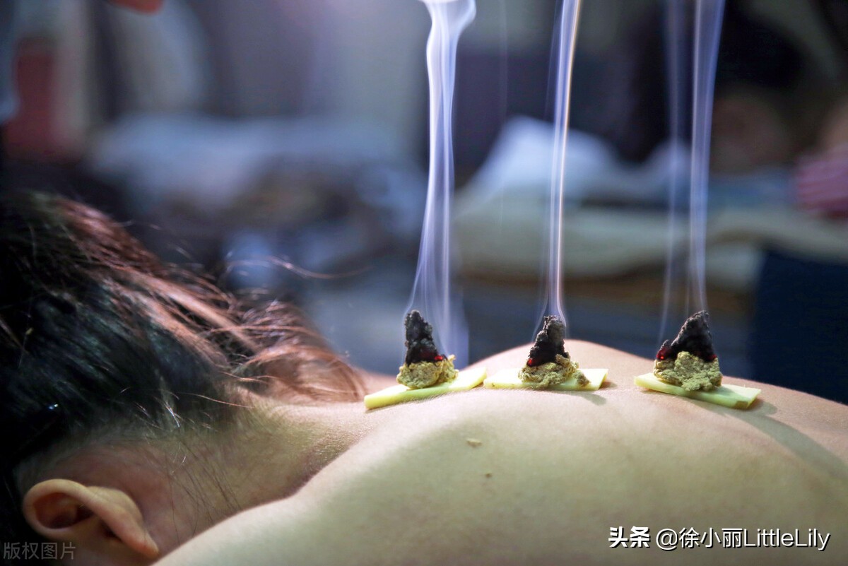 灸法直论书全集最精辟的讲解灸法之秘