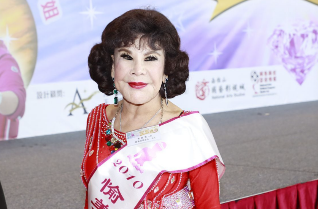 6位"整容脸"的女星,个个面部僵硬,笑比哭还难看