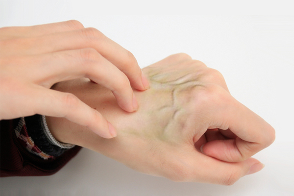 血管堵没堵塞，手上有信号？一个动作，测测你的血管“抵抗力”