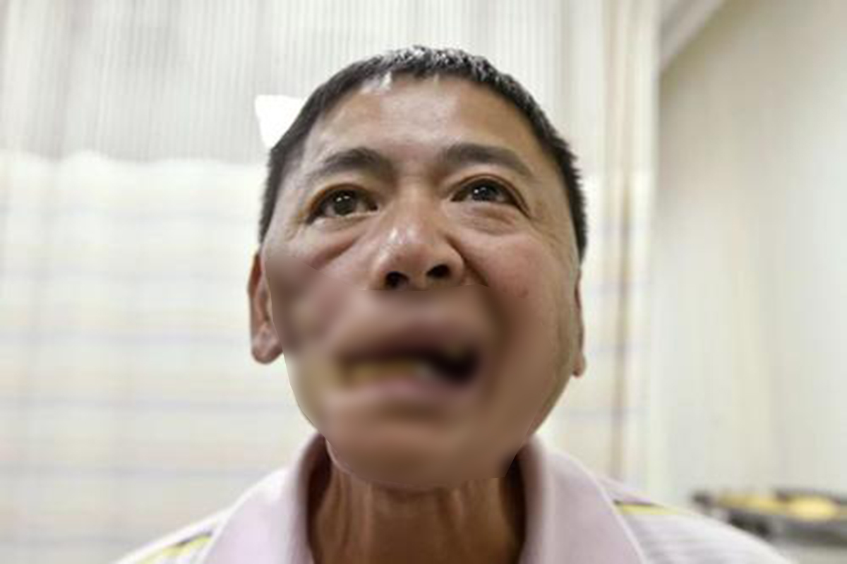 槟榔之殇:成瘾只是表象,6000万人的爱好,如何成割脸的诱因