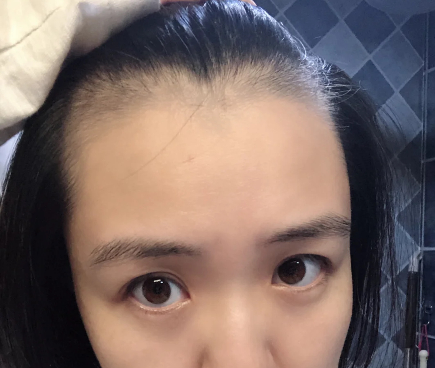 发际线后移的人多有这五个坏习惯(为什么现在人发际线后移的这么多)