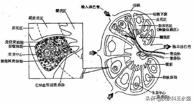 淋巴结出现这几个异常，暗示身体有病？对照看看，以免恶变