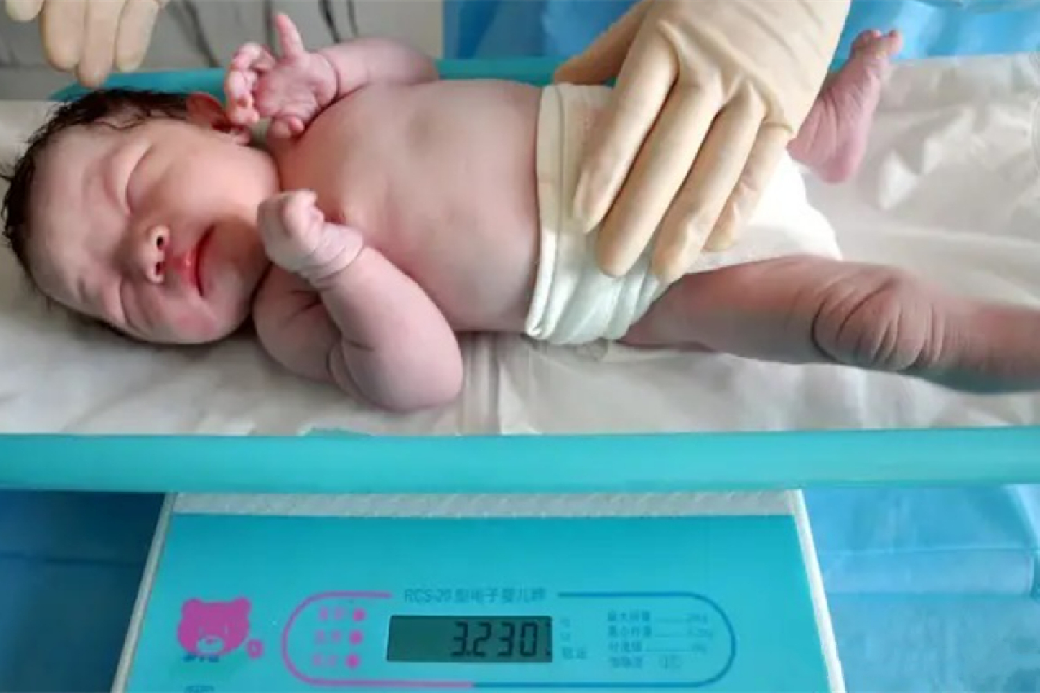 哈尔滨300斤产妇生下“巨大儿”，重11斤，健康孕育不可忽视