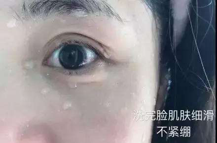 长期用洁面皂洗脸的女孩，皮肤经历了哪些变化？今天告诉你答案