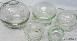 健康科普堂 | 拔罐讲义