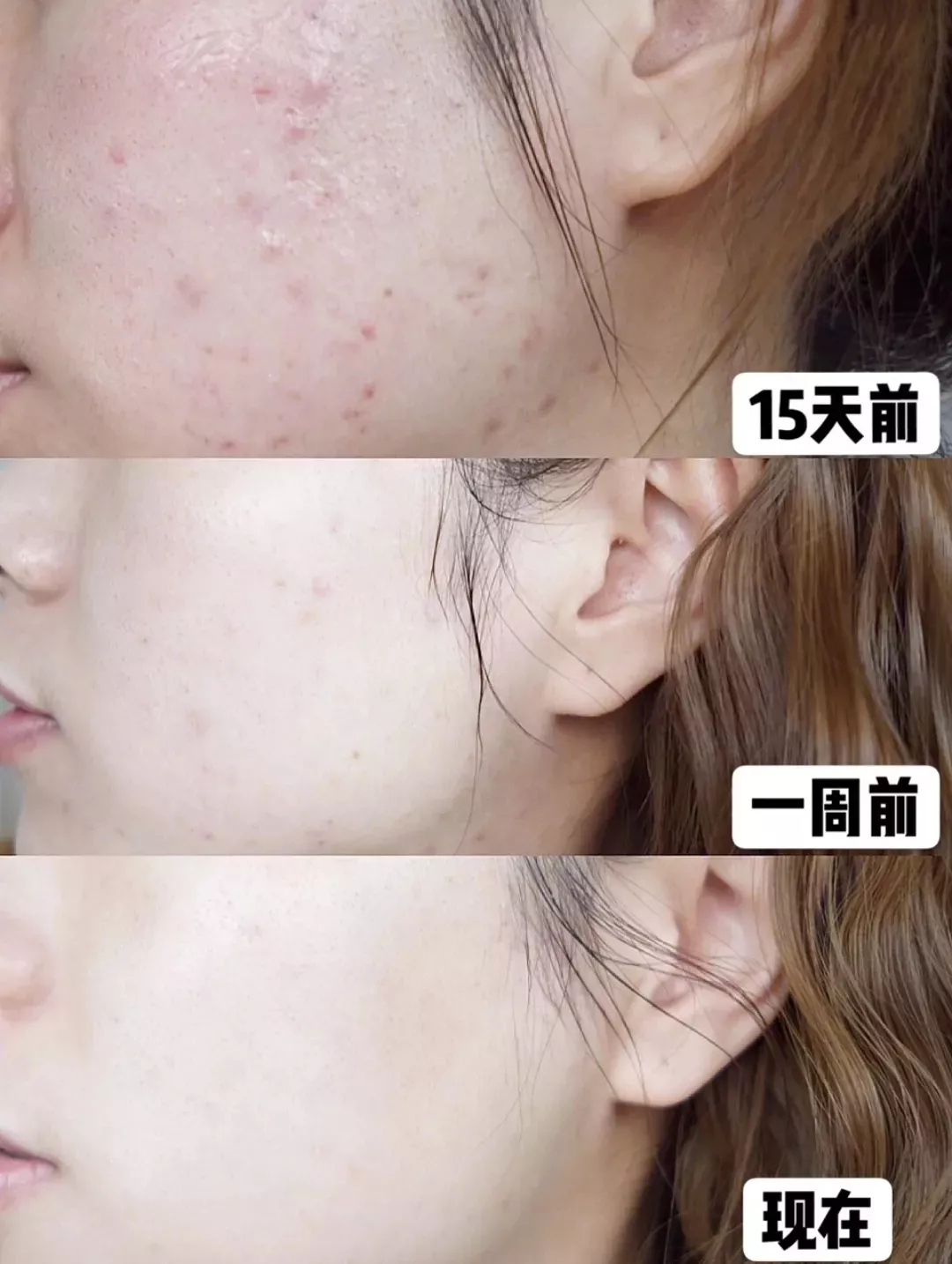 这款被称作“神奇”的泥膜，得到张韶涵力荐：草莓鼻用几次就好了