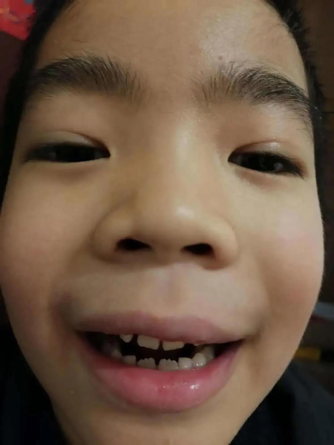 老师,我掉牙了怎么办?丨一千零一叶·第3叶