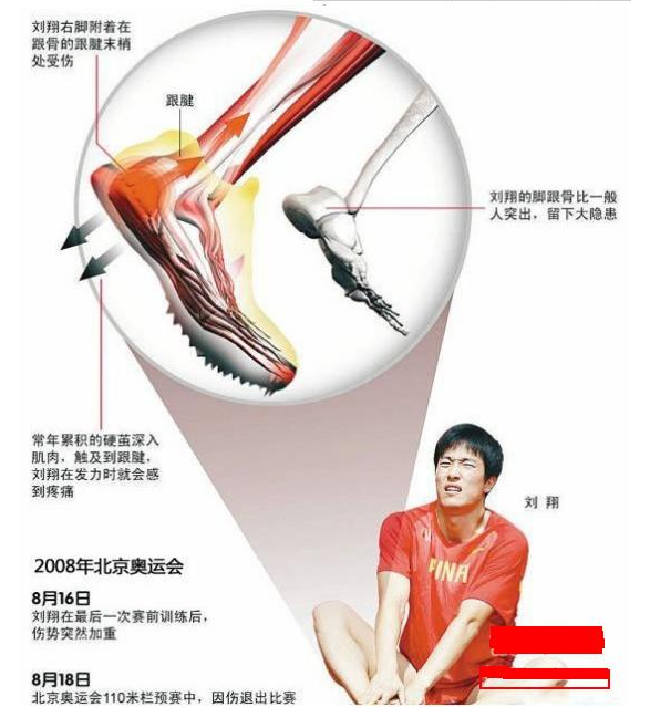 刘翔是假摔吗2008刘翔假摔十大证据