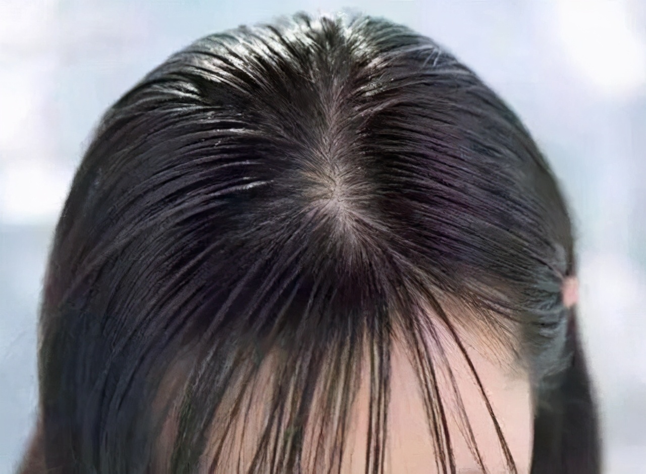 两个小妙招轻松搞定,拒绝油腻发型靓丽