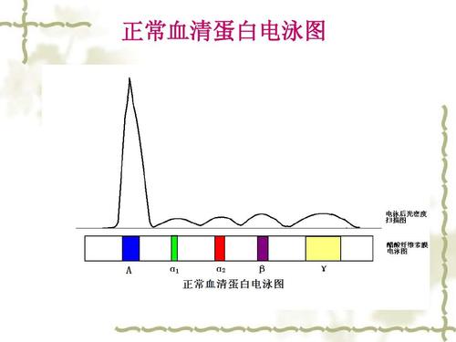 到医院输免疫球蛋白能提高抵抗力？愿望是美好的，真相是残酷的