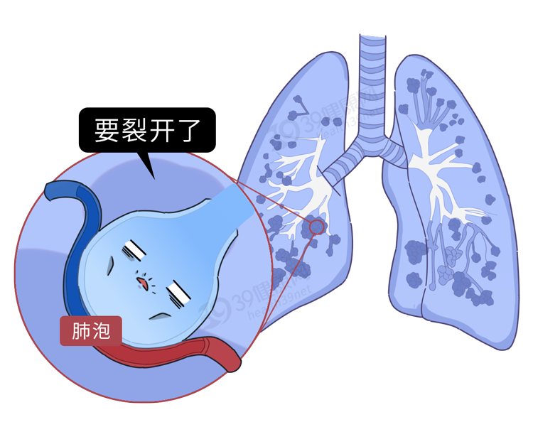 这些病都是被“气”出来的！看完这6大危害，别生气，气病没人替