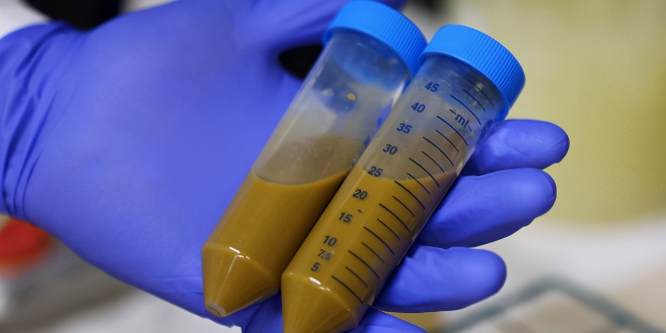 捐粪一次300元，每天拉粑粑即年入79200元，难度堪比高考