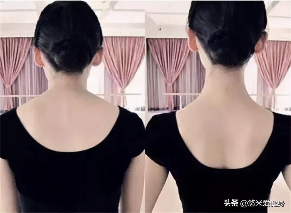 女生脖子太粗不好看，每天训练4个动作，帮你快速消除斜方肌