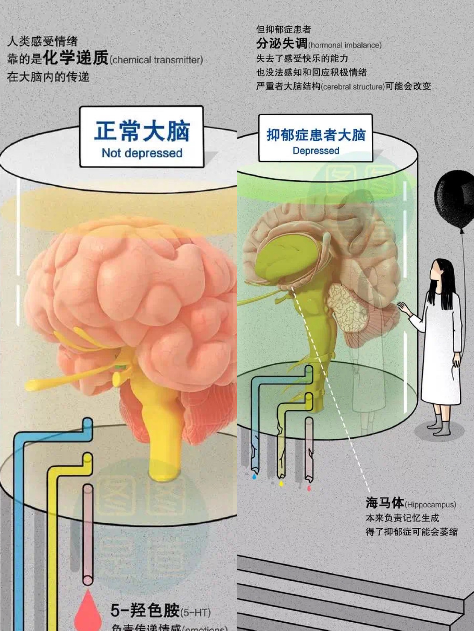 心理学：抑郁症患者彩票中奖5千万也很难好，原因很简单