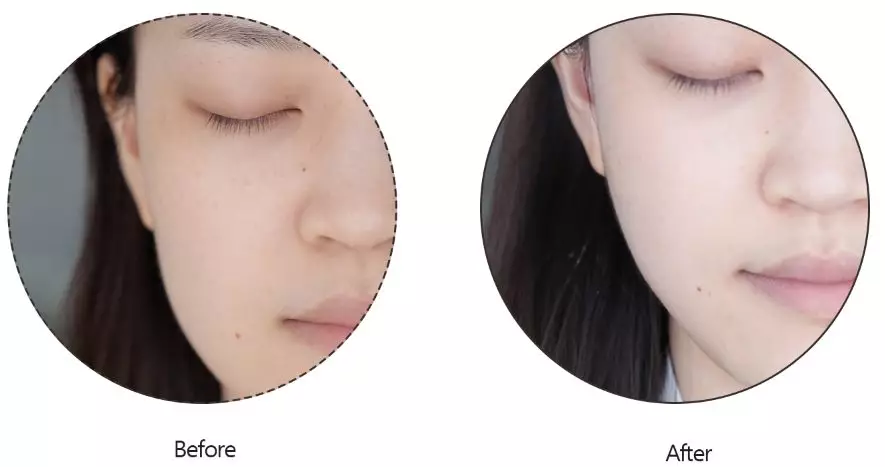 熬夜救星—菲洛嘉十全大补面膜