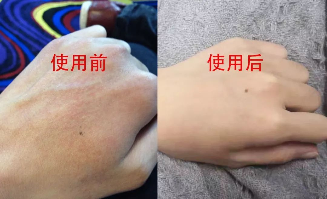 手纹深干燥、粗糙真显老！这支法国“换皮护手霜”，拯救干燥皱纹