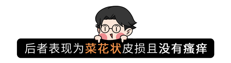 疥螨到底是什么？感染后有何症状？这2种传播途径，男女都要小心