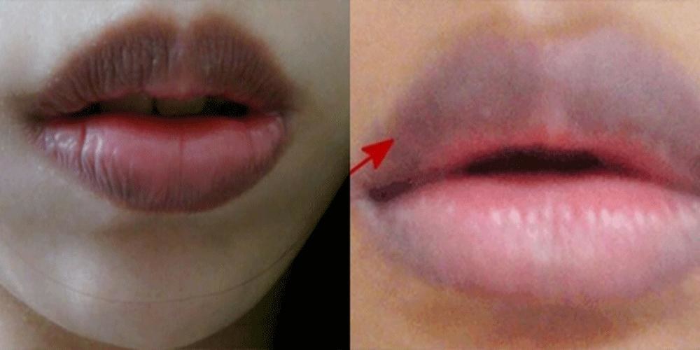 嘴唇是“照妖镜”，3种怪异颜色，很可能是患「大病」了，别拖延