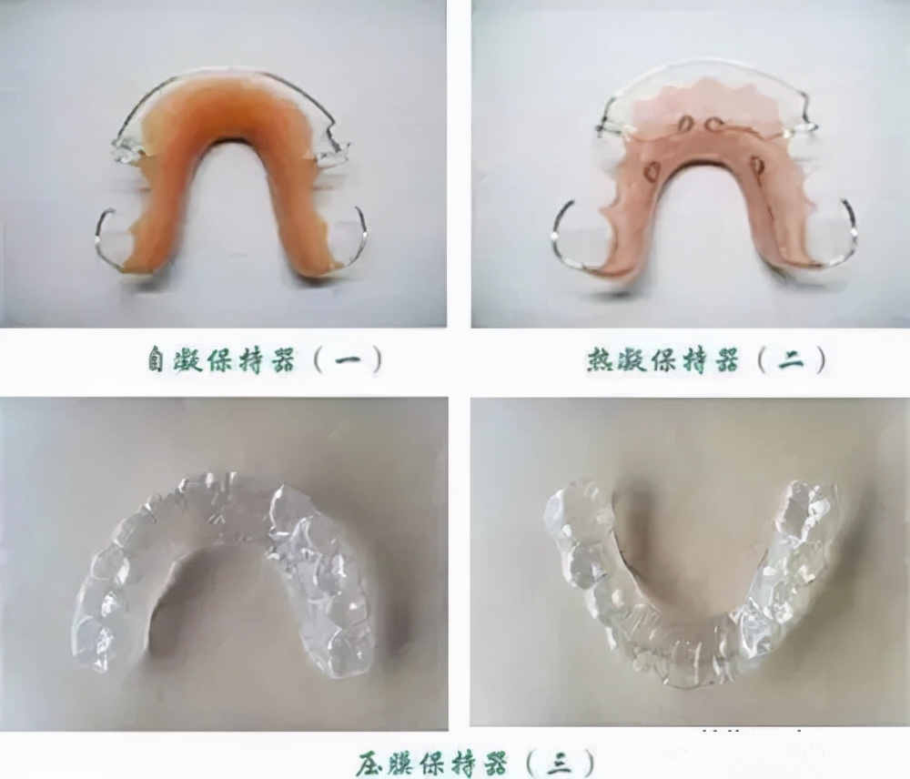 郑州牙齿矫正蔡留意教授：重中之重-矫正后的保持器